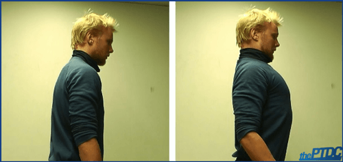 Scapular retration