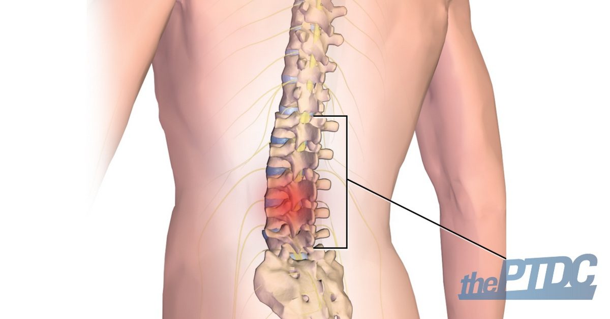 A Trainer S Guide To Help Treat And Fix Lower Back Pain Theptdc The Ptdc