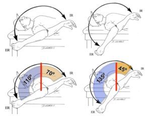 gird-glenohumeral-internal-rotation-deficit