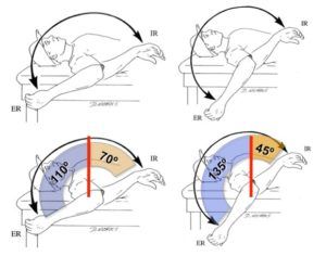 gird-glenohumeral-internal-rotation-deficit