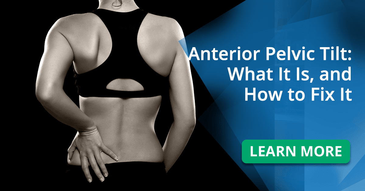 What Is Anterior Pelvic Tilt And How To Fix It What Is Anterior