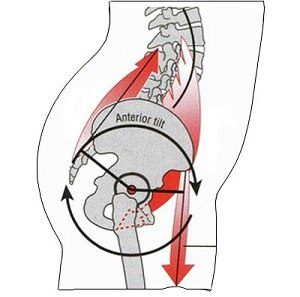 anatomical-diagram-of-anterior-pelvic-tilt