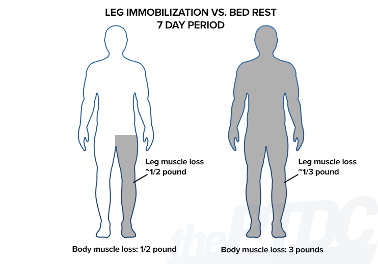 leg-immobilization-vs-bed-rest-muscle-loss